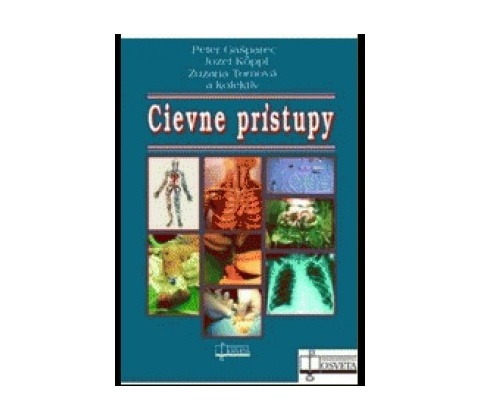 Cievne prístupy