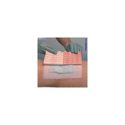 MOLNLYCKE Mefix fixace 10mx2.5cm 310250