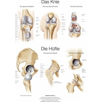 Schéma - anatomie lidské kyčle a kolene Papír s lištou