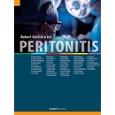Peritonitis