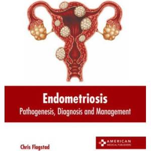 Endometriosis: Pathogenesis, Diagnosis and Management | Chris Flagstad (ISBN: 9781639276677)