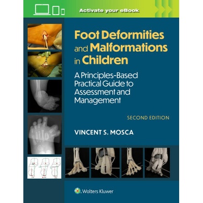 Foot Deformities and Malformations in Children - Vincent Mosca