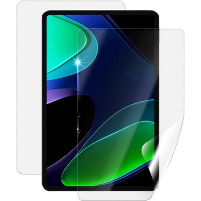 Screenshield XIAOMI Pad 6 fólie na celé tělo XIA-P6-B – Zbozi.Blesk.cz