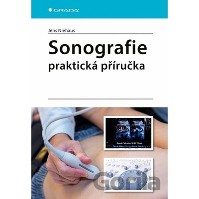 Sonografie Praktická příručka