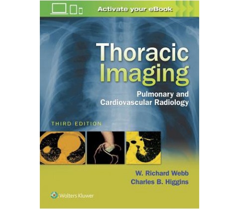 Thoracic Imaging Webb W.Richard