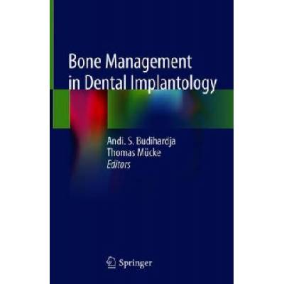 Bone Management in Dental Implantology | Andi. S. Budihardja, Thomas Mücke