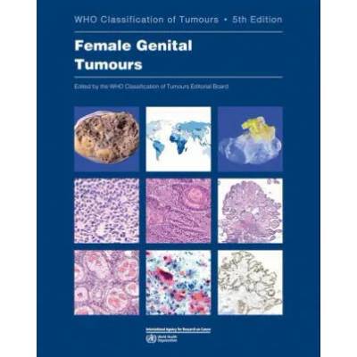Female Genital Tumours: Who Classification of Tumours