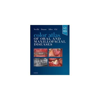 Color Atlas of Oral and Maxillofacial Diseases Neville Brad W. DDSPevná vazba