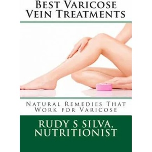 Best Varicose Vein Treatments: Natural Remedies That Work for Varicose | Rudy Silva Silva (ISBN: 9781481955836)