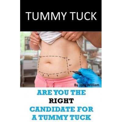 Tummy Tuck: Are You The Right Candidate For A Tummy Tuck