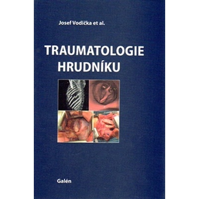 Traumatologie hrudníku