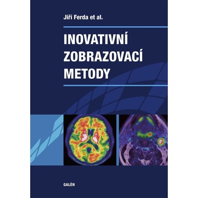 Inovativní zobrazovací metody Jiří Ferda