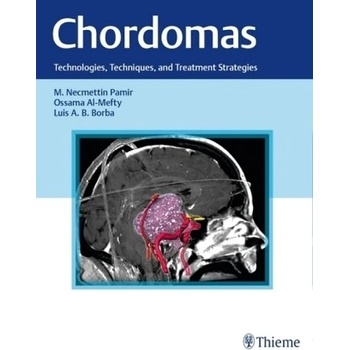Chordomas
