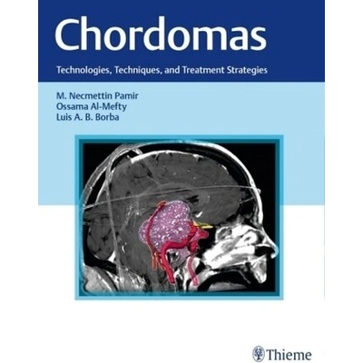 Chordomas