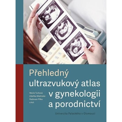 Přehledný ultrazvukový atlas v gynekologii a porodnictví - Marie Turková, Zdeňka Malínská, Radovan Pilka, kolektiv autorů