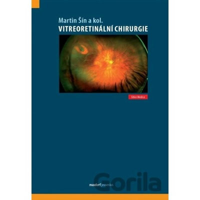 Vitreoretinální chirurgie