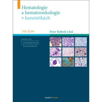 Rohoň, Peter - Hematologie a hematoonkologie v kazuistikách