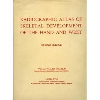 Image 1 of Radiographic Atlas of Skeletal Development of the Hand and Wrist | Greulich