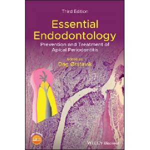 Essential Endodontology - Prevention and Treatment of Apical Periodontitis, 3rd Edition (ISBN: 9781119271956)