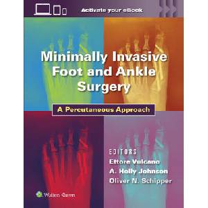 Minimally Invasive Foot and Ankle Surgery | Vulcano, Dr. Ettore, MD, Johnson, Holly, MD, Oliver Schipper (ISBN: 9781975198701)