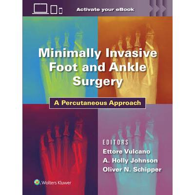 Minimally Invasive Foot and Ankle Surgery | Vulcano, Dr. Ettore, MD, Johnson, Holly, MD, Oliver Schipper