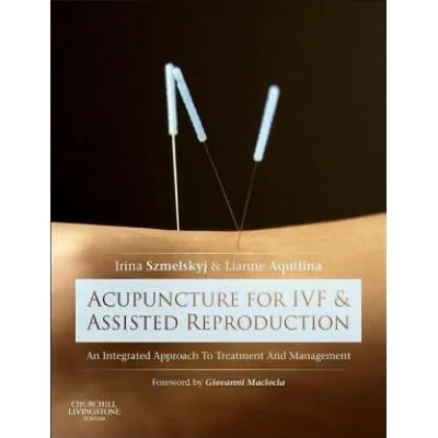 Acupuncture for IVF and Assisted Reproduction | Irina Szmelskyj
