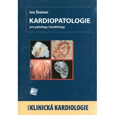 Kardiopatologie pro patology i kardiology - Ivo Šteiner