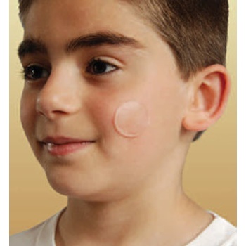 New Gel 380 průhledná bodová náplast vyhlazení jizvy v obličeji 1 ks