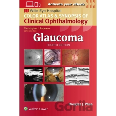 Glaucoma: Wills Eye Institute Atlas Series - Douglas J. Rhee