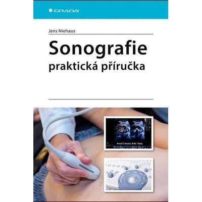 Sonografie Praktická příručka