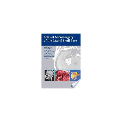 Atlas of Microsurgery of the Lateral Skull Base Sanna MarioPevná vazba