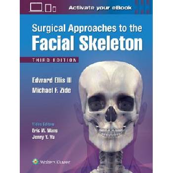 Surgical Approaches to the Facial Skeleton | Edward Ellis, Michael F. Zide