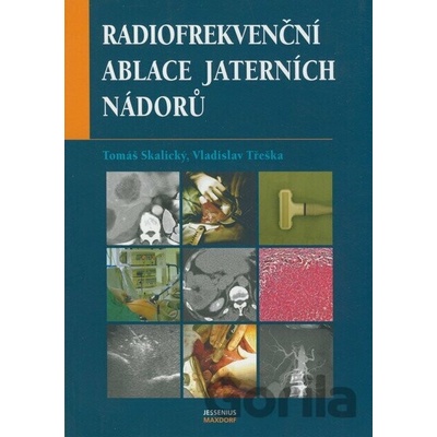 Radiofrekvenční ablace jaterních nádorů - Tomáš Skalický, Vladislav Třeška