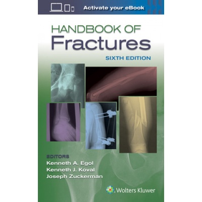 Handbook of Fractures | Egol