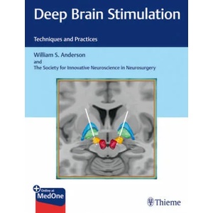 Deep Brain Stimulation | William Anderson (ISBN: 9781626237971)
