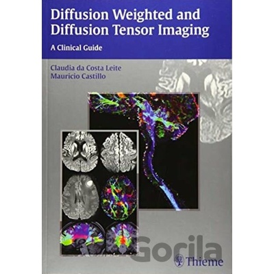 Diffusion Weighted and Diffusion Tensor Imaging