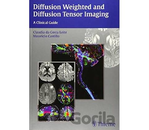 Diffusion Weighted and Diffusion Tensor Imaging