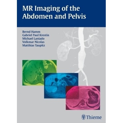 MR Imaging of the Abdomen and Pelvis - Hamm, Bernd
