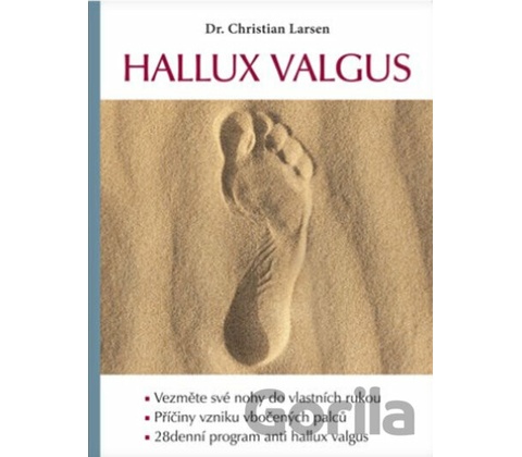 Hallux valgus
