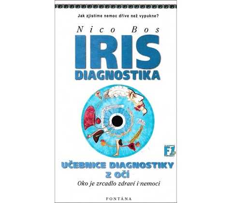Iris diagnostika