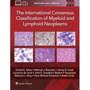 The International Consensus Classification of Myeloid and Lymphoid Neoplasms | ARBER, DANIEL A (ISBN: 9781975222598)
