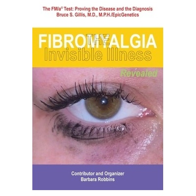 Fibromyalgia: The Invisible Illness, Revealed Robbins BarbaraPaperback