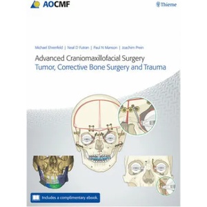 Advanced Craniomaxillofacial Surgery | Paul Manson, Neal D. Futran, Joachim Prein (ISBN: 9783132428393)