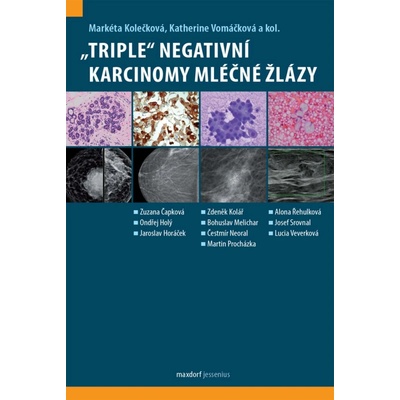 Maxdorf „Triple“ negativní karcinomy mléčné žlázy Markéta Kolečková, Katherine Vomáčková a kol.