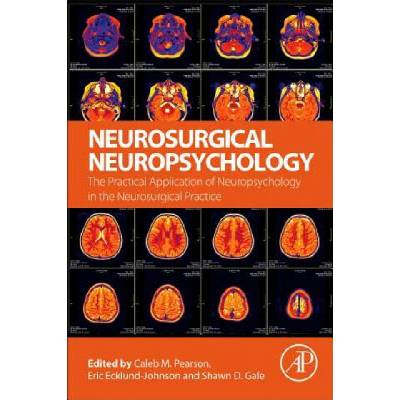 Neurosurgical Neuropsychology