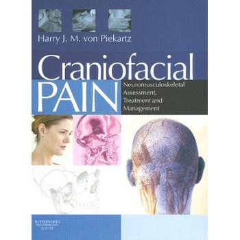 Craniofacial Pain