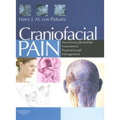 Craniofacial Pain