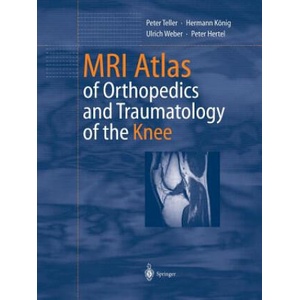 MRI Atlas of Orthopedics and Traumatology of the Knee | Peter Teller, Hermann König, Ulrich Weber, Peter Hertel (ISBN: 9783642628856)