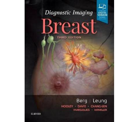 Diagnostic Imaging: Breast