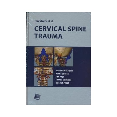 Cervical spine trauma - Jan Štulík